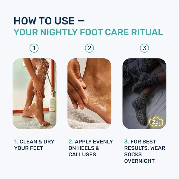 Mexmy_20%_Urea_Foot_Cream_Roll_On_100gm_|_For_Dry_&_Cracked_Heels_|_With_2%_Salicylic_Acid,_Olive_Oil_&_Vitamin_E_|_Helps_Repair_and_Moisturise_Cracked_Heels_(Pack_Of_2-200gm)