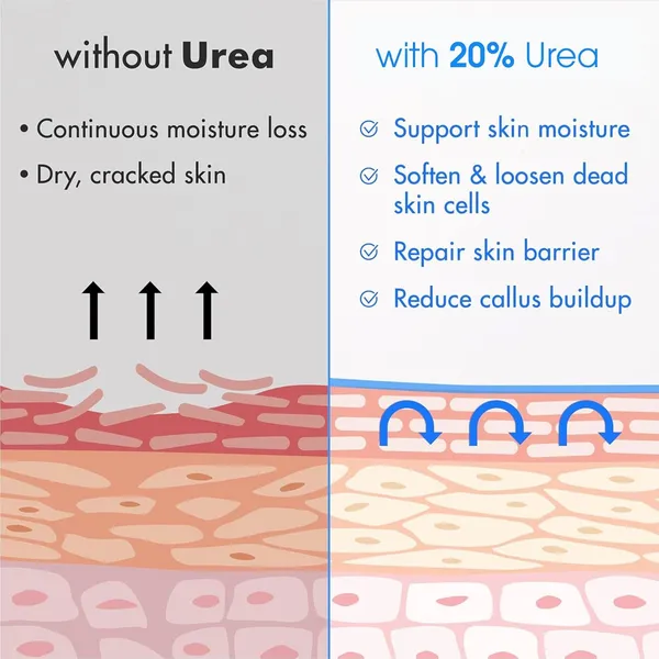 Mexmy_20%_Urea_Foot_Cream_Roll_On_100gm_|_For_Dry_&_Cracked_Heels_|_With_2%_Salicylic_Acid,_Olive_Oil_&_Vitamin_E_|_Helps_Repair_and_Moisturise_Cracked_Heels_(Pack_Of_2-200gm)