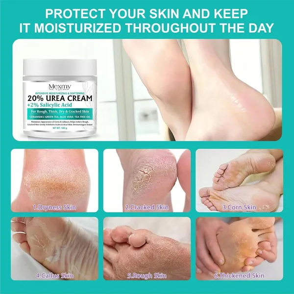 Mexmy_20%_Urea_Foot_Cream_Roll_On_100gm_|_For_Dry_&_Cracked_Heels_|_With_2%_Salicylic_Acid,_Olive_Oil_&_Vitamin_E_|_Helps_Repair_and_Moisturise_Cracked_Heels_(Pack_Of_2-200gm)