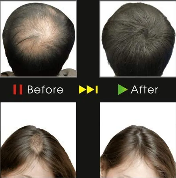Black_Hair_Building_With_Natural_Cotton_Fiber_15_g_Pack_Of_1_Hair_Loss_Concealer_For_Men_And_Women_Instant_Hair_Thickener_For_Thinning_Hair