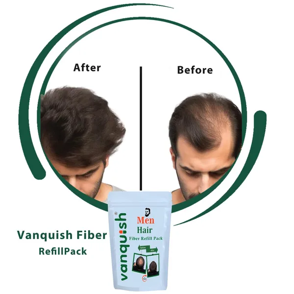 Light_Brown_Men_Hair_Fibers_100_gFor_Thinning_Hair_&_Bald_Spots_Refill_Pack_Conceals_Hair_Loss_In_Seconds
