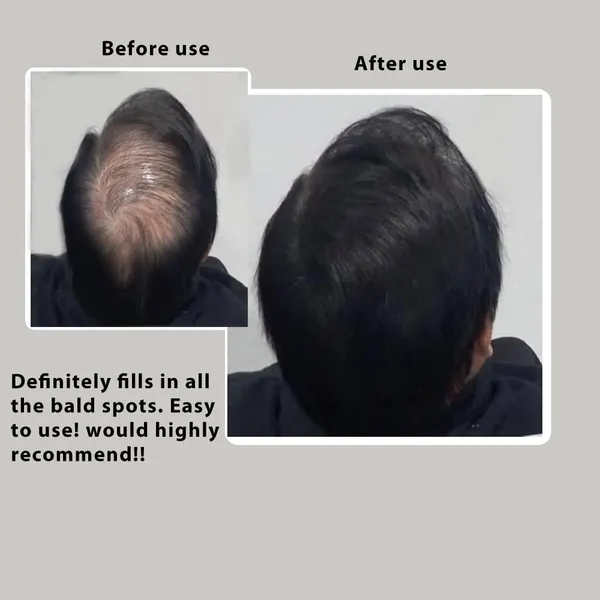 Dark_Brown_Men_Hair_Building_With_Natural_Cotton_Fiber_25g_Pack_Of_1_Hair_Loss_Concealer_For_Men_Instant_Hair_Thickener_For_Thinning_Hair.