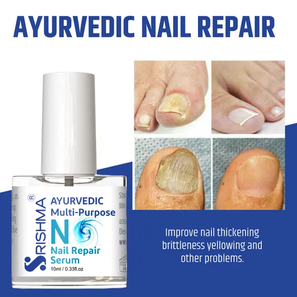 Nail_Repair_Serum_For_Stimulates_Nail_Growth,_For_Damaged_Skin_&_Thin_Nails_(100%_Natural)