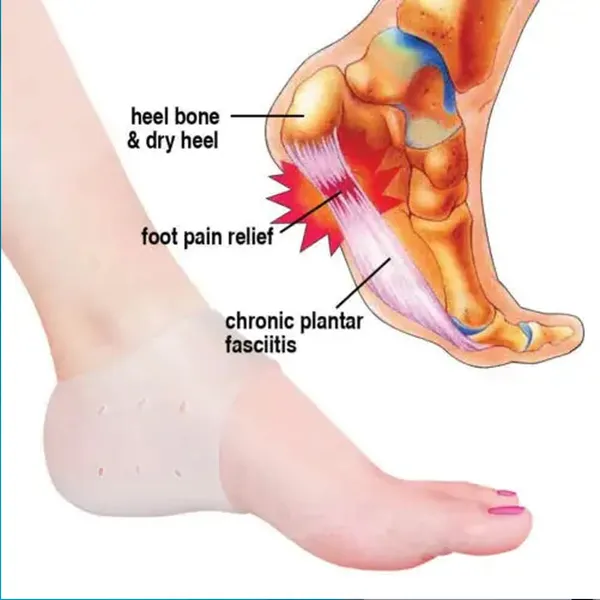 Beige_Silicone_Moisturizing_Heel_Forefoot_&_Foot_Swelling_Pain_Relief_Foot_Support_To_Eliminate_Cracks_(Full)
