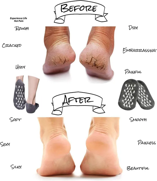 Grey_Pink_Soften_Moisturising_Spa_Comfy_Recovery_Foot_Hand_Care_Gel_Socks_And_Gloves