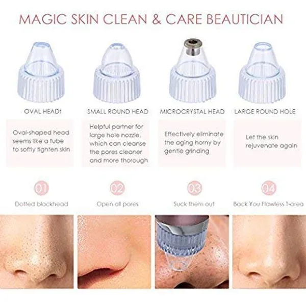 White_Head_Remover_Pore_Vacuum_-_Electric_Microdermabrasion_Machine_Head_Cleaning_Tool_Pimple_Sucker_&_Facial_Cleanser_Device_For_Pores_Acne_Nose_Skin