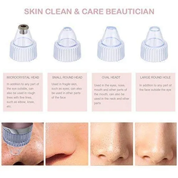 White_Head_Remover_Pore_Vacuum_-_Electric_Microdermabrasion_Machine_Head_Cleaning_Tool_Pimple_Sucker_&_Facial_Cleanser_Device_For_Pores_Acne_Nose_Skin