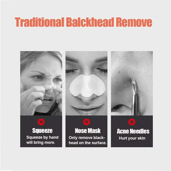 Blue_Hot_And_Cold_Compress_Head_Vacuum_Suction_Pore_Vacuum_Cleaner_Facial_Head_Acne_Removal_Tools_Light_Photon_Rejuvenation_Skin_Care