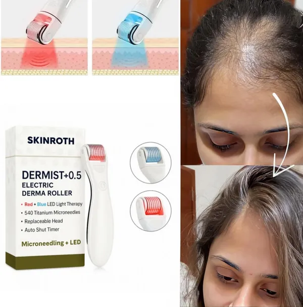 Titanium_Electric_Derma_Roller_0.5Mm__Replaceable_540_Microneedle_Head_With_Red_Light_Therapy__Boost_Hair_Growth_&_Rejuvenate_Skin__Fast_Result.