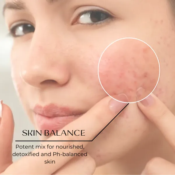 FOR_OILY_SKIN:_Detoxifying_Soap_Bar