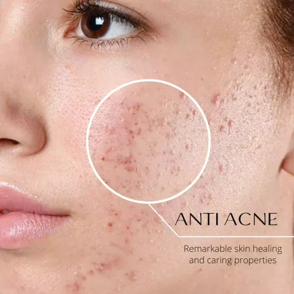 FOR_OILY_SKIN:_Deep_Clean_Radiance_Soap_Bar