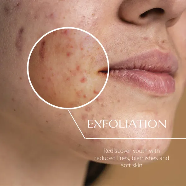 Exfoliating_Soap_Bar