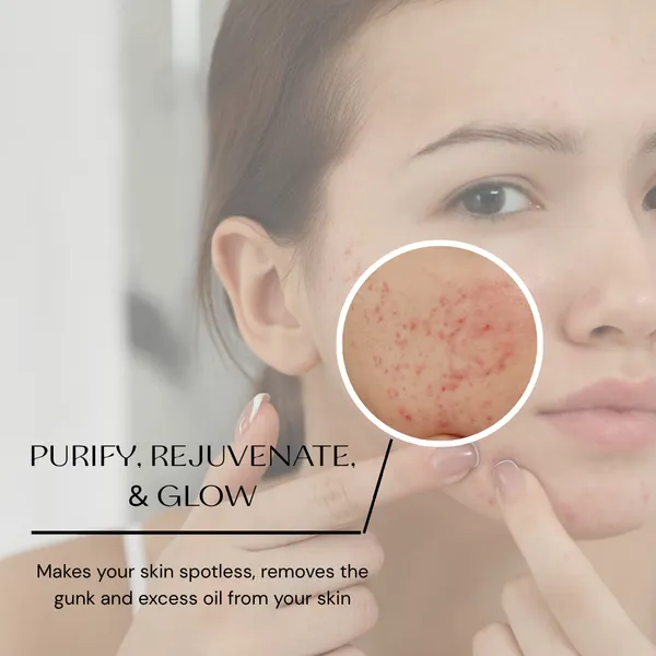 Anti_Acne_Face_Pack