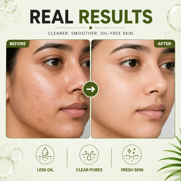 Oily_Skin_Toner_|_Fights_Pimples,Tightens_Pores_&_Controls_Oil_|_Glycolic_Acid_&_Tea_Tree