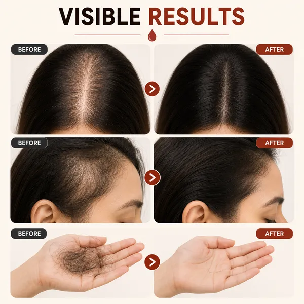 Hairfall_control_Hair_Oil_|_Reduces_Hair_Fall_&_Promotes_Hair_Growth_|_Rosemary_&_Gooseberry_|_100%_Pure_&_Natural