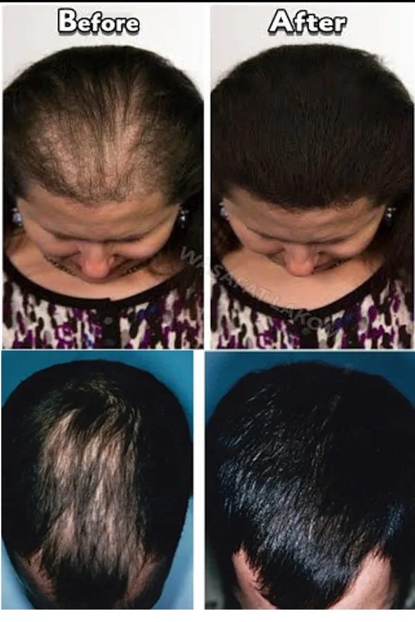 Amla_+_Hibiscus_+_Bhringraj_Powders_Combo_100%_Natural_For_Hair_&_Growth_(Combo_Of_3_Pouches)_For_Healthy_Hair_Care_&_Healthy_Growth