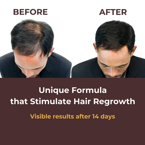 Hair_Reviv_Serum_For_Regrowth_Serum_|Prevents_Hair_Fall_&_Soothes_Scalp|_Promotes_Hair_Growth_,_50Ml