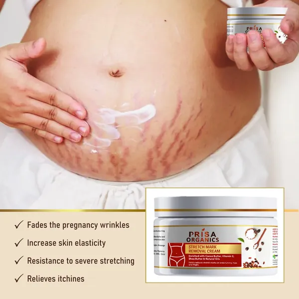 Stretch_Mark_Removal_Cream_Suitable_For_Tummy,_Hips,_Bust_And_Thighs,_100G_With_48_Hour_Glow