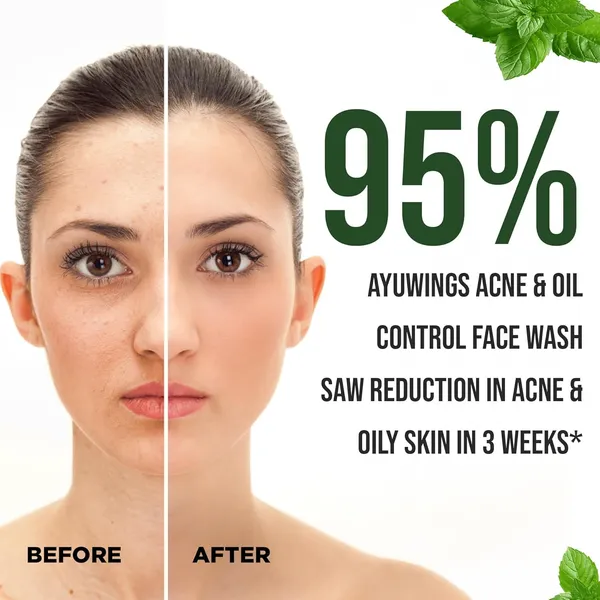Acne_and_Oil_Control_Face_Wash