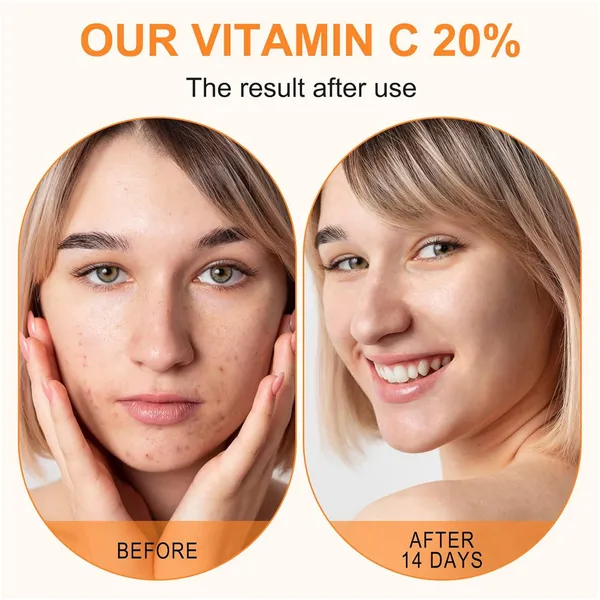 Vitamin_C_Face_Serum_Brightens_And_Boosts_Radiance