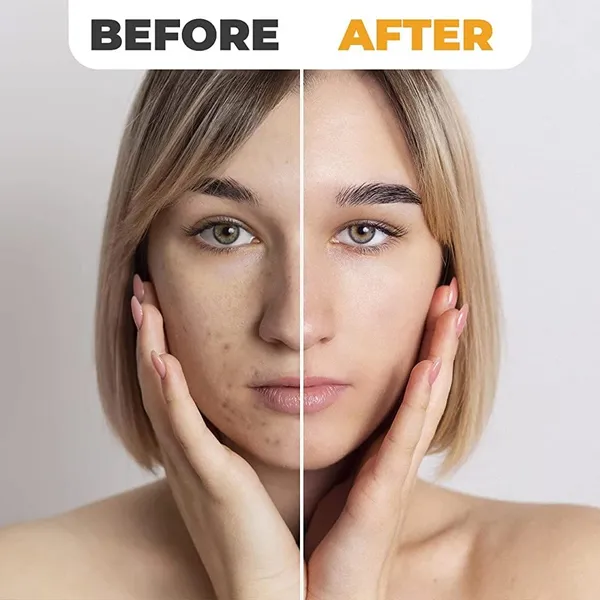 Vitamin_C_Face_Serum_30_Ml_Brightening_&_Dark_Spot_Care_For_Healthy_Glowing_Skin