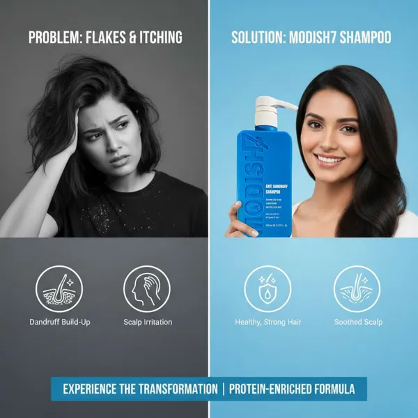 Modish7_Anti_Dandruff_Shampoo_Soothes_Dry_Scalp_For_All_Hair_Types_1183_Fl_Oz_350_Ml_Soothes_Dry_Scalp_Shampooing_Antipelliculaire