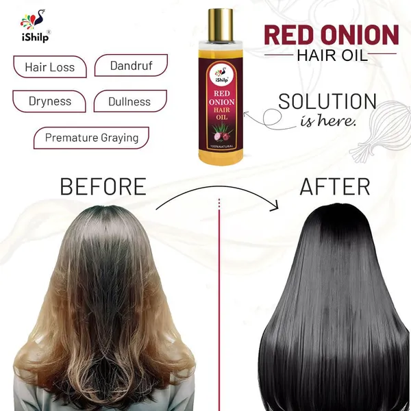 Red_Onion_Hair_Oil_|_For_Hair_Growth_&_Fall_Control_|_200ml