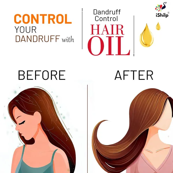 Anti_Dandruff_&_Scalp_Care_Herbal_Hair_Oil_|_200ml