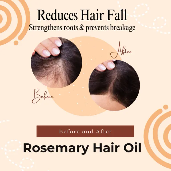 Rosemary_Organic_Hair_Growth_Oil