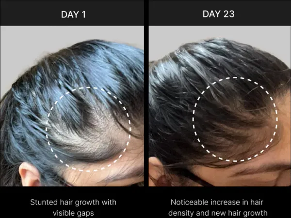 100%_Organic_Rice-based_Shampoo_And_Conditioner_Combo_Pack_3