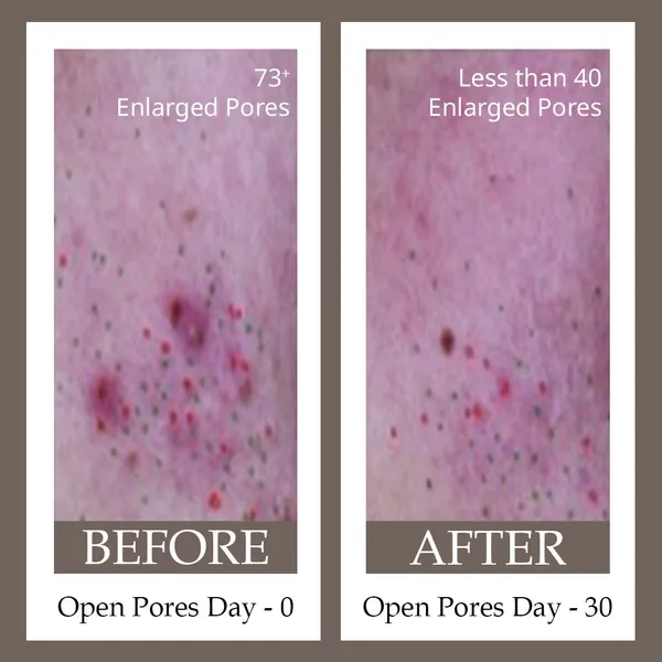 Pore_Minimising_Face_Serum