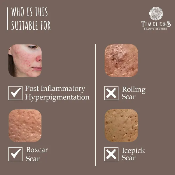 Acne_Scar_Reduction_Regime_-_Mild_To_Moderate_-_100ml+50ml