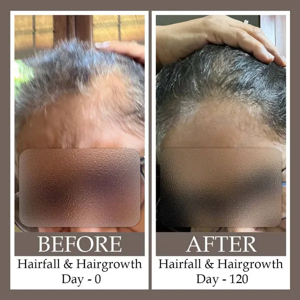 Hair_Growth_&_Hair_Loss_Oil