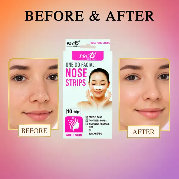 PRC_HERBAL_Nose_Pore_Strips_White_Skin_For_Blackhead_Removal_And_Pore_Tightening_Herbal_Deep_Cleansing_Nose_Pore_Strips_Removes_Dirt,_Oil_&_Whiteheads_(Each_Pack_Contain10_Strips)_Pack_Of_4