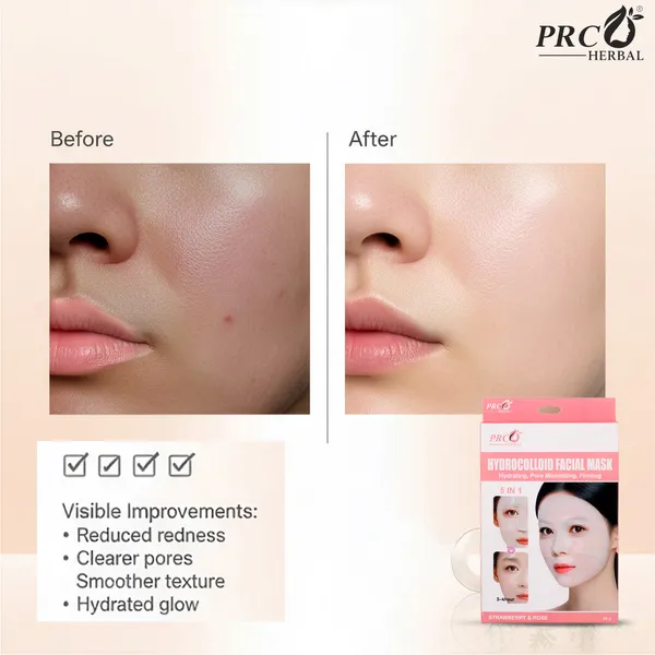 PRC_HERBAL_–_HYDROCOLLOID_FACIAL_SHEET_MASK_(STRAWBERRY_&_ROSE)__PACK_OF_4