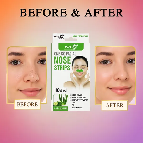 PRC_HERBAL_Nose_Pore_Strips_Aloevera_&_Cucumbar_For_Blackhead_Removal_And_Pore_Tightening_Herbal_Deep_Cleansing_Nose_Pore_Strips_Removes_Dirt,_Oil_&_Whiteheads_(Each_Pack_Contain_10_Strips)_Pack_Of_4