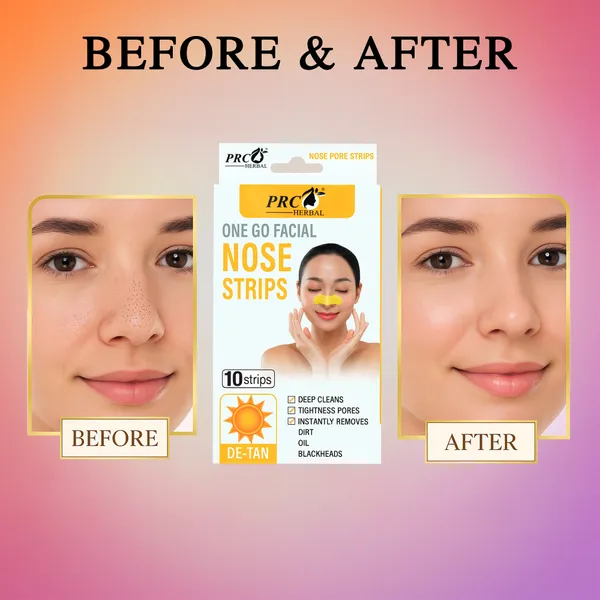 PRC_HERBAL_Nose_Pore_Strips_D-Tan_For_Blackhead_Removal_And_Pore_Tightening_Herbal_Deep_Cleansing_Nose_Pore_Strips_Removes_Dirt,_Oil_&_Whiteheads_(Each_Pack_Contain_10_Strips)_Pack_Of_2
