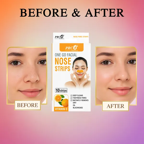 PRC_HERBAL_Nose_Pore_Strips_Vitamin-C_For_Blackhead_Removal_And_Pore_Tightening_Herbal_Deep_Cleansing_Nose_Pore_Strips_Removes_Dirt,_Oil_&_Whiteheads_(Each_Pack_Contain_-_10_Strips)_Pack_Of_4_