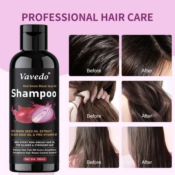 Onion_Shampoo_For_Hair_Fall_Control_–_Strengthens_Roots,_Promotes_Hair_Growth,_Natural_Sulfate-Free_Formula_-_100Ml