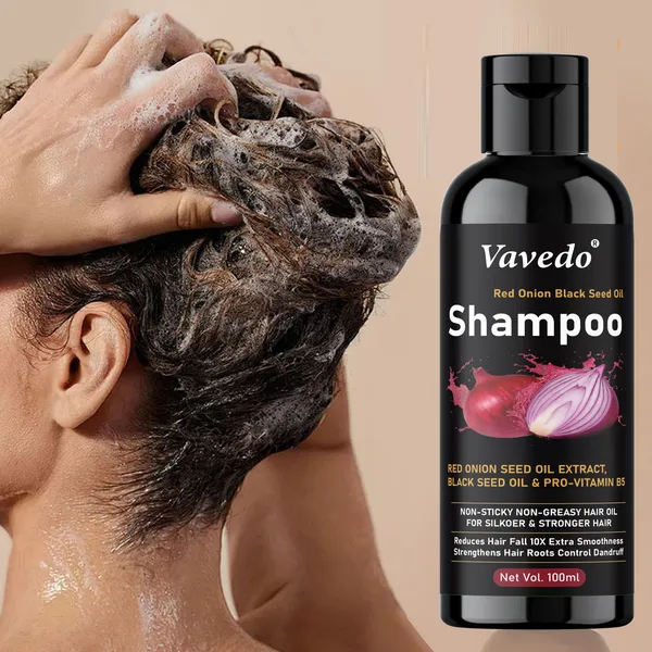 Onion_Shampoo_For_Hair_Fall_Control_–_Strengthens_Roots,_Promotes_Hair_Growth,_Natural_Sulfate-Free_Formula_-_100Ml_(Pack_Of_5)