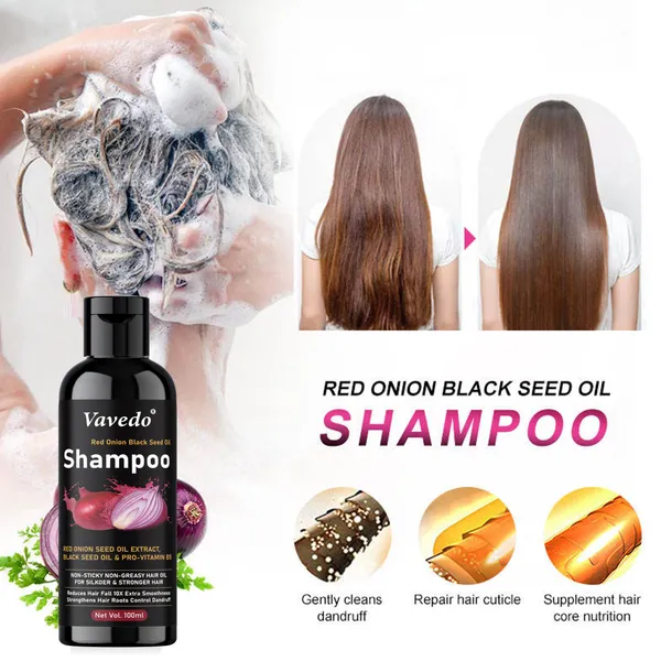 Onion_Shampoo_For_Hair_Fall_Control_–_Strengthens_Roots,_Promotes_Hair_Growth,_Natural_Sulfate-Free_Formula_-_100Ml_(Pack_Of_5)
