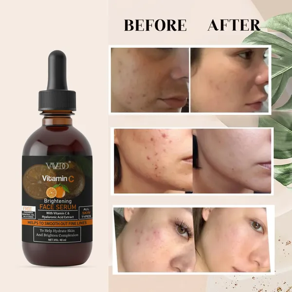 Vitamin_C_Face_Serum_|_Brightening_&_Anti-Aging_Serum_For_Glowing_Skin,_For_Oily_Skin,_All_Skin_Type_–_30Ml_(Pack_Of_2)