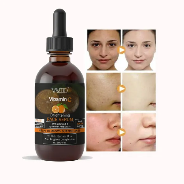 Vitamin_C_Face_Serum_|_Brightening_&_Anti-Aging_Serum_For_Glowing_Skin,_Oily_Skin,_All_Skin_Type_–_30Ml