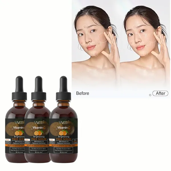 Vitamin_C_Face_Serum_|_Brightening_&_Anti-Aging_Serum_For_Glowing_Skin_–_30Ml_(Pack_Of_3)