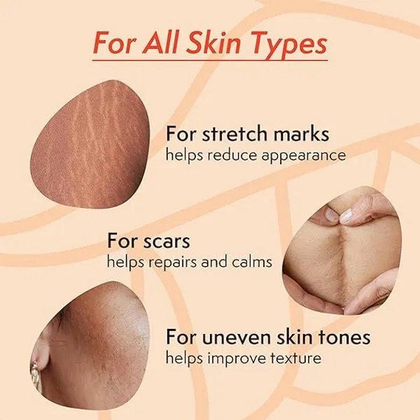 Cow_Ghee_Stretch_Mark_Oil-_100_Ml,_100%_Natural_Ayurvedic_Formula,_Pregnancy_Safe,_Dermatologically_Tested,_No_Mineral_Oil,_No_Silicone,_No_Paraben