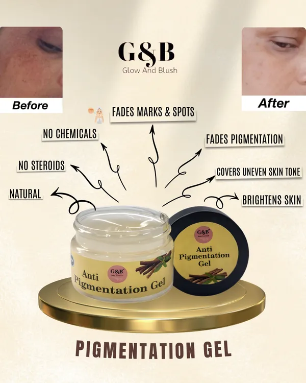 Anti_Pigmentation_Gel