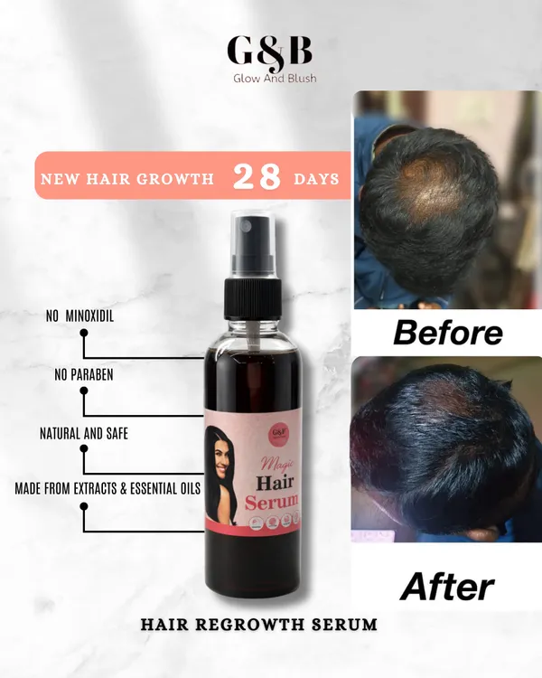 Hair_Regrowth_Serum_Natural_And_Result_Oriented