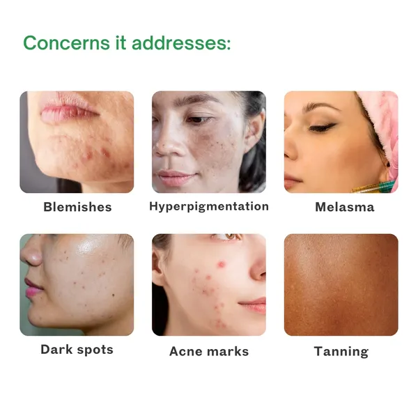 Skin_lightening_and_Brightening_cream