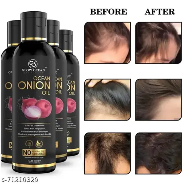 Glowocean_Onion_Oil_-_Onion_Hair_Oil_|_Onion_Hair_Growth_Oil_|_Onion_Hair_Serum_|_Onion_Tel_|_Hair_Oil_Onion_|_Hair_Oil_Almond_|_Adivasi_Hair_Oil_|_Coconut_Hair_Oil_|_Sesame_Hair_Oil_|_Olive_Oil_|_Rosemary_Oil_|_Jojoba_Hair_Oil_|_Levender_Essential_Oil_(_Pack_Of_4)