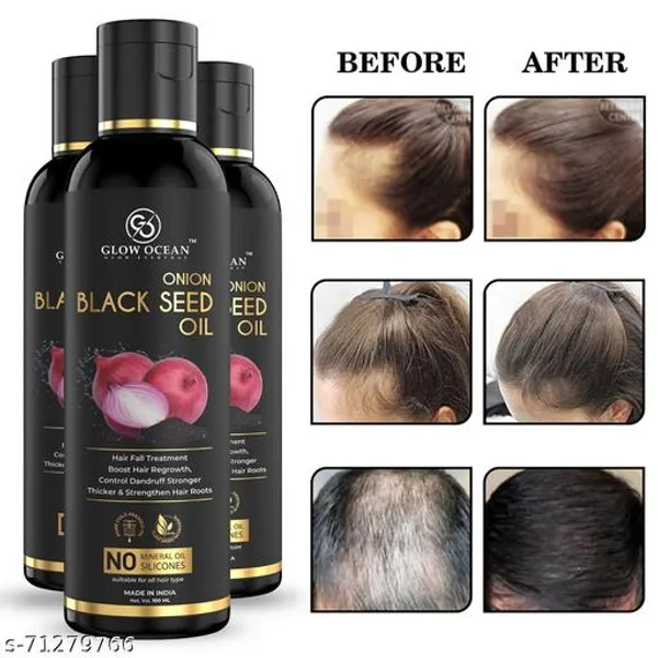 Ocean_Onion_Blackseed_Hair_Oil_For_Hair_Fall_Control_|_Hair_Growth_Oil_|_Hair_Regrowth_Oil_|_Almond_Hair_Oil_|_Coconut_Hair_Oil_|_Hair_Oil_|_Red_Onion_Hair_Oil_|_Castor_Oil_|_Sesame_Oil_For_Hair_|_Bal_Ugane_Ka_Tel_|_Bal_Lamba_Karne_Wala_Tel_|_Aloevera_Oil_For_Hair|_Kalonji_Seed_Oil